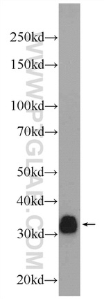 CD20 Antibody in Western Blot (WB)
