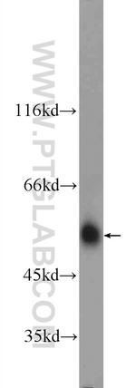 ARMC5 Antibody in Western Blot (WB)