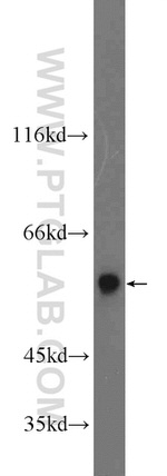 ARMC5 Antibody in Western Blot (WB)