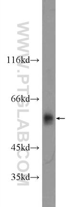 ARMC5 Antibody in Western Blot (WB)