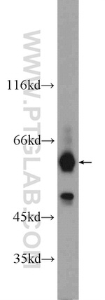 ARMC5 Antibody in Western Blot (WB)