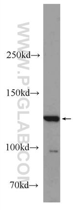 BAIAP3 Antibody in Western Blot (WB)