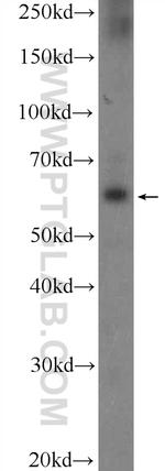POTEH Antibody in Western Blot (WB)