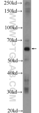 POTEH Antibody in Western Blot (WB)