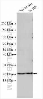 TNN Antibody in Western Blot (WB)