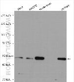 SETD7 Antibody in Western Blot (WB)