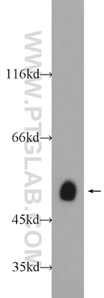 SETD7 Antibody in Western Blot (WB)