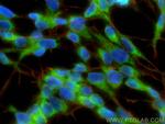 KIF1A Antibody in Immunocytochemistry (ICC/IF)