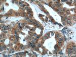 PDF Antibody in Immunohistochemistry (Paraffin) (IHC (P))