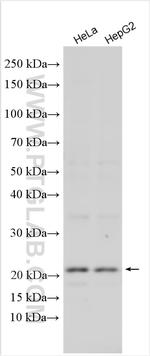 SZRD1 Antibody in Western Blot (WB)