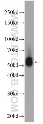 KLHDC5 Antibody in Western Blot (WB)