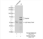 Spartan Antibody in Immunoprecipitation (IP)