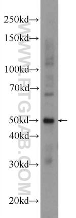 GAL3ST3 Antibody in Western Blot (WB)