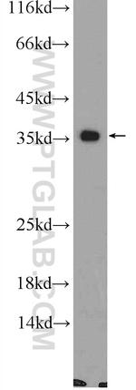 CNTD1 Antibody in Western Blot (WB)