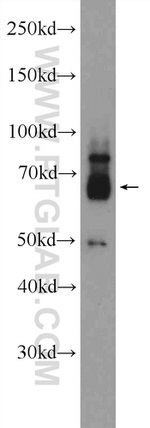 ZNF195 Antibody in Western Blot (WB)