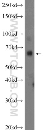 ZNF195 Antibody in Western Blot (WB)