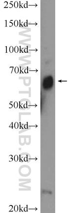 ZNF195 Antibody in Western Blot (WB)