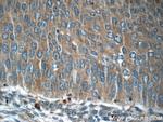 C13orf37 Antibody in Immunohistochemistry (Paraffin) (IHC (P))