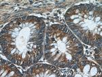 LRCH2 Antibody in Immunohistochemistry (Paraffin) (IHC (P))