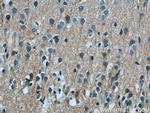LRCH2 Antibody in Immunohistochemistry (Paraffin) (IHC (P))