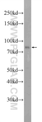 LRCH2 Antibody in Western Blot (WB)