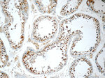 C22orf41 Antibody in Immunohistochemistry (Paraffin) (IHC (P))