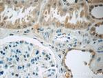 CWF19L2 Antibody in Immunohistochemistry (Paraffin) (IHC (P))