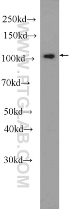 CWF19L2 Antibody in Western Blot (WB)