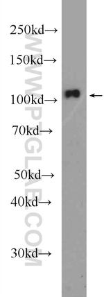 CWF19L2 Antibody in Western Blot (WB)
