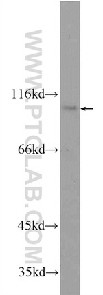 CWF19L2 Antibody in Western Blot (WB)