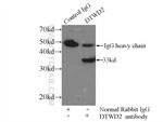 DTWD2 Antibody in Immunoprecipitation (IP)