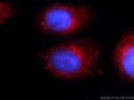 WDR81 Antibody in Immunocytochemistry (ICC/IF)