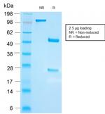 FSH-beta (Follicle Stimulating Hormone-beta) Antibody in SDS-PAGE (SDS-PAGE)