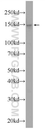 URB2 Antibody in Western Blot (WB)
