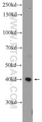 ZNF320 Antibody in Western Blot (WB)