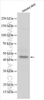 C1orf161 Antibody in Western Blot (WB)