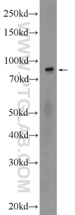 POGK Antibody in Western Blot (WB)