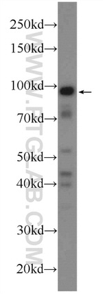 POGK Antibody in Western Blot (WB)
