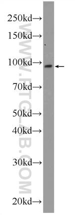 POGK Antibody in Western Blot (WB)