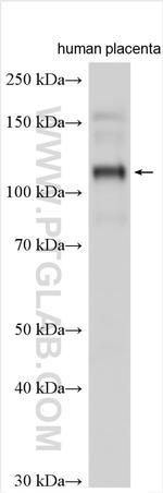 ANKFY1 Antibody in Western Blot (WB)