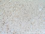 TMEM161A Antibody in Immunohistochemistry (Paraffin) (IHC (P))