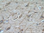 TMEM161A Antibody in Immunohistochemistry (Paraffin) (IHC (P))