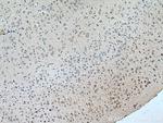 TMEM161A Antibody in Immunohistochemistry (Paraffin) (IHC (P))