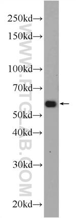 TMEM161A Antibody in Western Blot (WB)