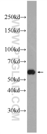 TMEM161A Antibody in Western Blot (WB)