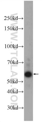 TMEM161A Antibody in Western Blot (WB)