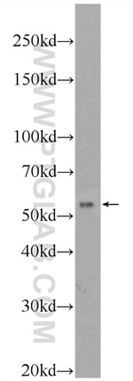 TMEM161A Antibody in Western Blot (WB)