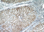 LRP5 Antibody in Immunohistochemistry (Paraffin) (IHC (P))