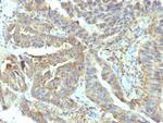 Alkaline Phosphatase (Tissue-Nonspecific) Monoclonal Antibody (V17.1)