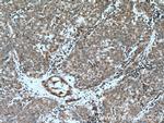 GRAMD1B Antibody in Immunohistochemistry (Paraffin) (IHC (P))